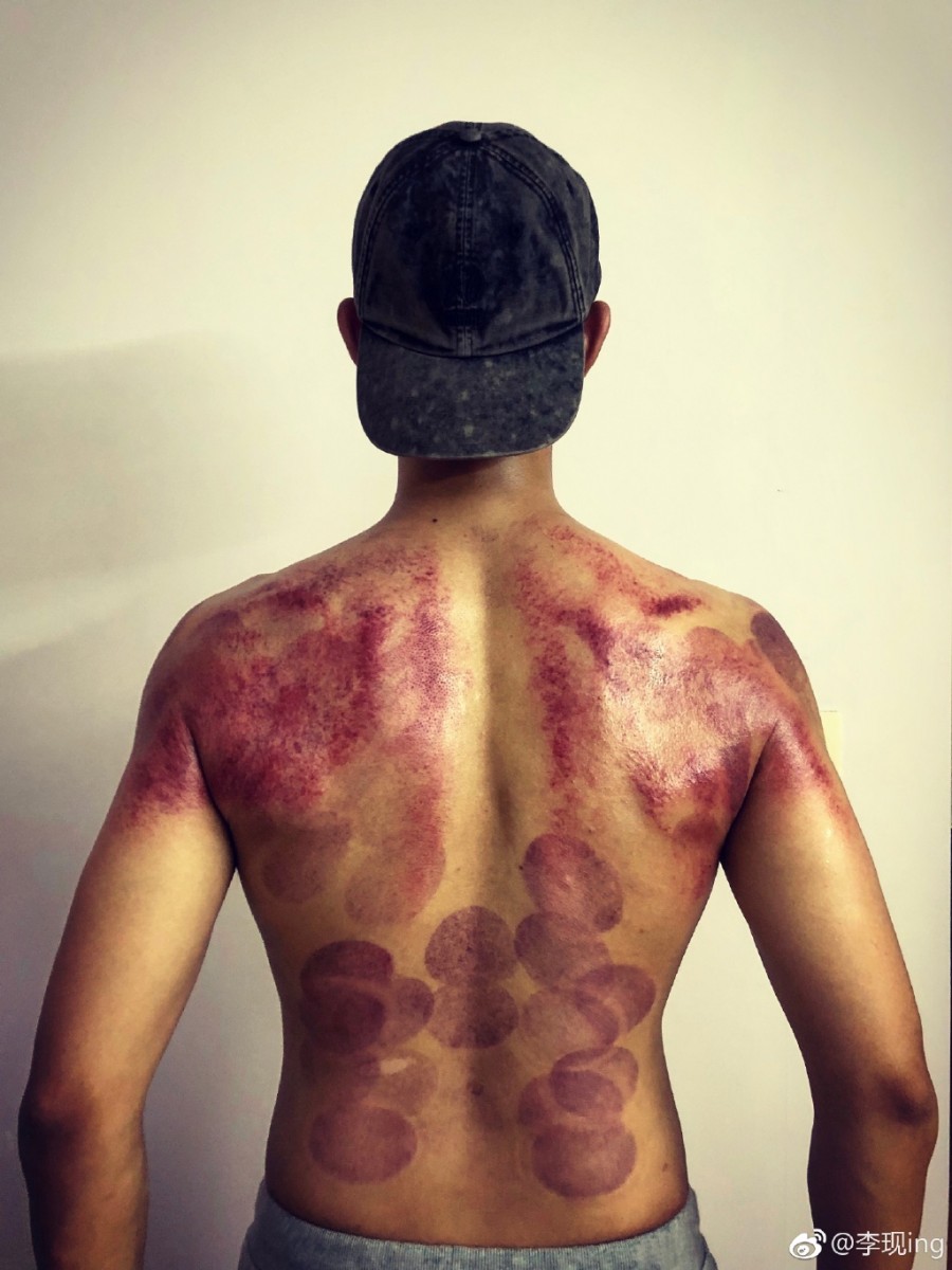 8cb725a7ly1fs29loens0j226q2x07wi