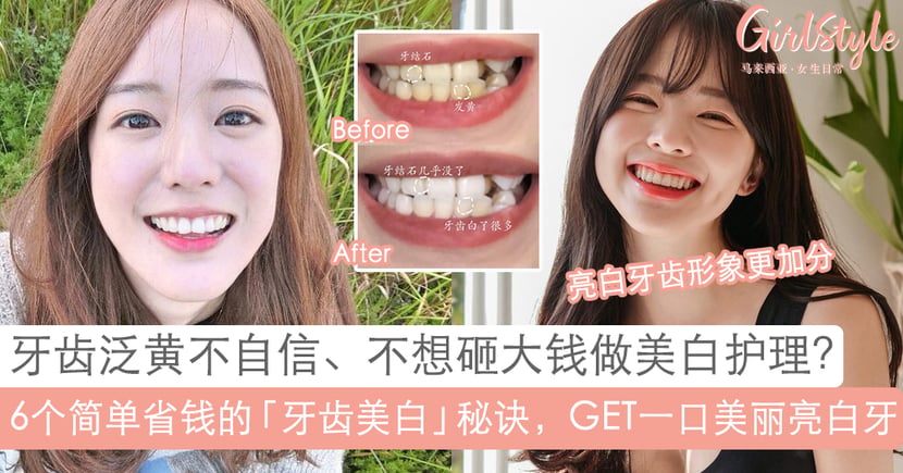别因为一口黄牙让颜值大扣分 亮白牙齿这样养成 详解6个天然又省钱的 终极牙齿美白秘诀 Girlstyle 马来西亚女生日常