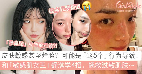 敏感肌毁颜值?详解5个导致皮肤敏感的日常NG行为!和舒淇女神学4招拯救肌肤~