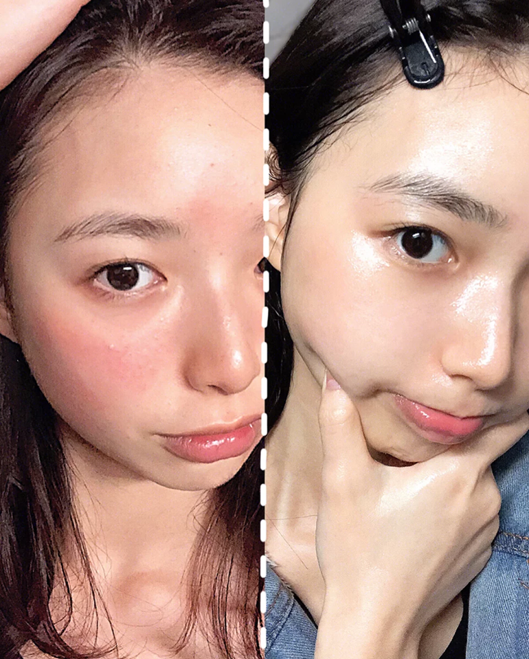 皮肤敏感甚至烂脸,除了是先天肤质问题,也可能是后天做了这五个NG行为!