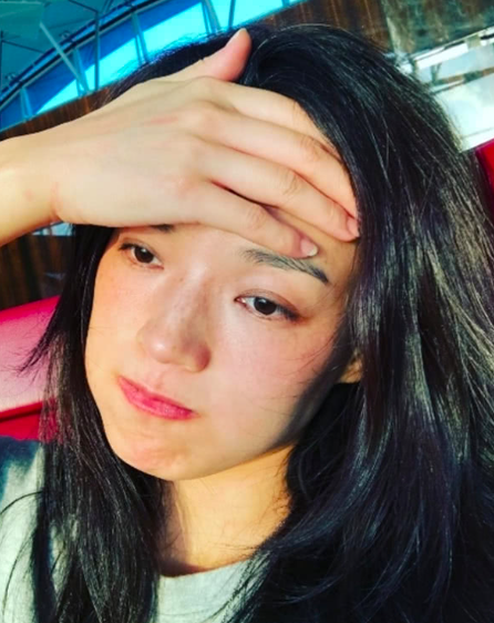 敏感肌症状一定要及时修护