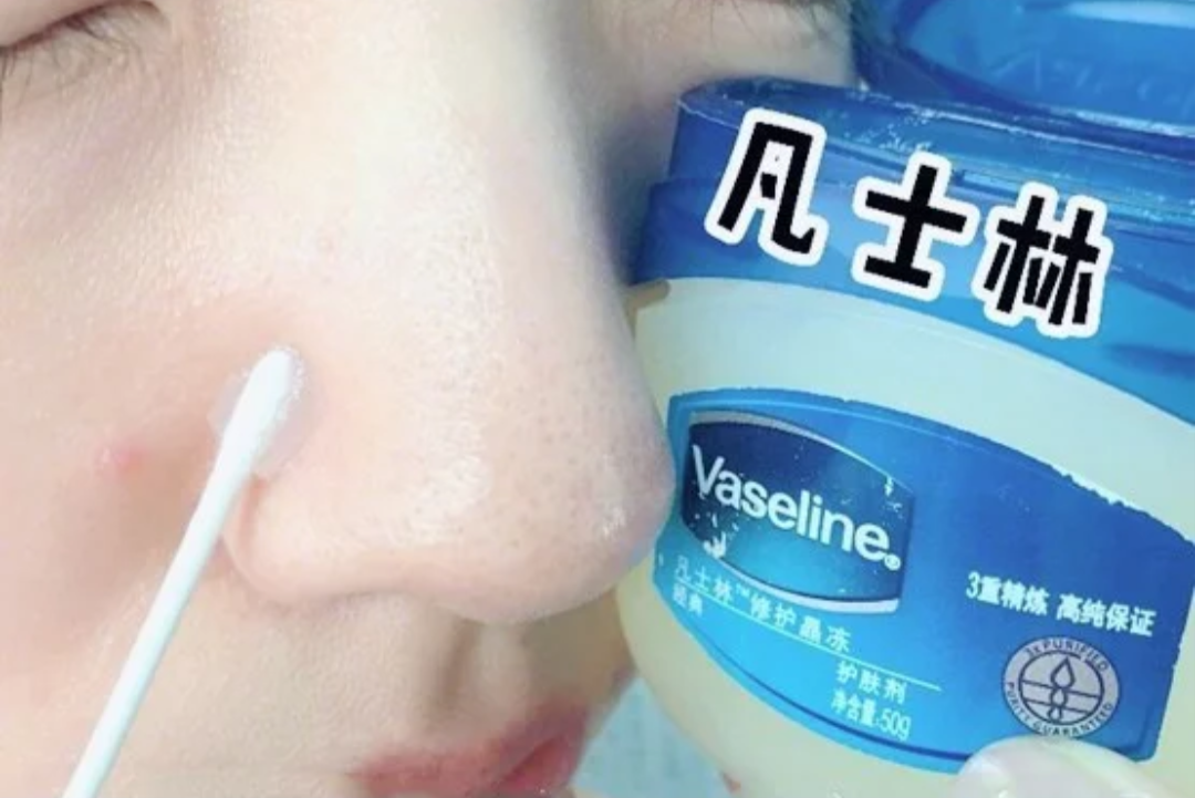 网传凡士林厚涂在鼻子上去除黑头粉刺 并不是每种肤质适用!