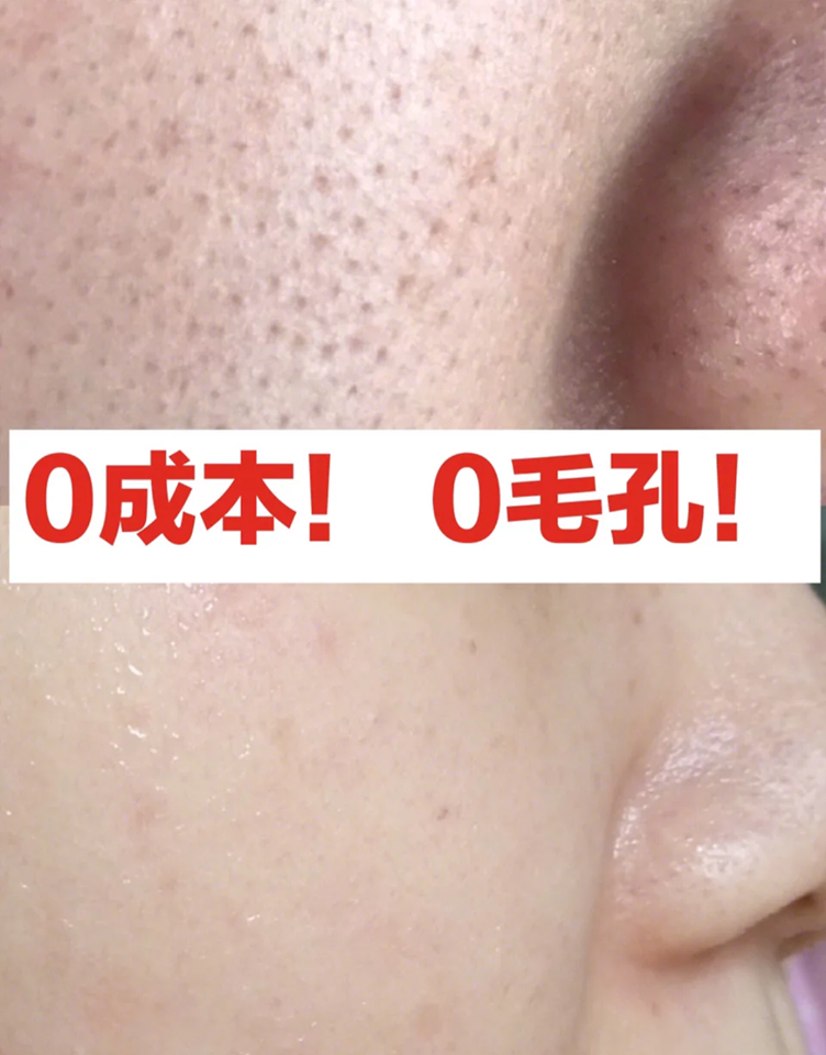 小红书博主们试过热敷法后都觉得效果惊艳!