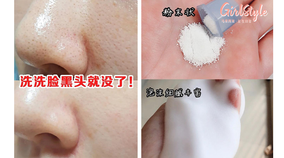 粗大毛孔 黑头粉刺111