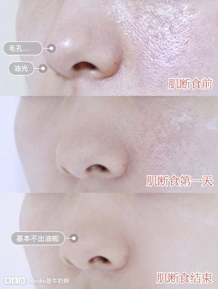 更详细的「肌断食」步骤: 不少小红书博主们开始纷纷尝试这样的肌肤疗法,尤其「7天肌断食」广受推荐: