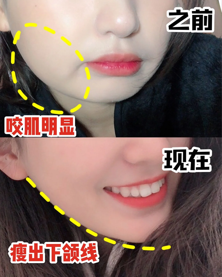 我们和高颜值的距离...或许只差了一张小V脸 / 下颌线(笑)今天来教大家几招有效瘦脸的日常妙招,配合勤做瘦脸按摩,相信没过多久就会看到效果喽~❤️
