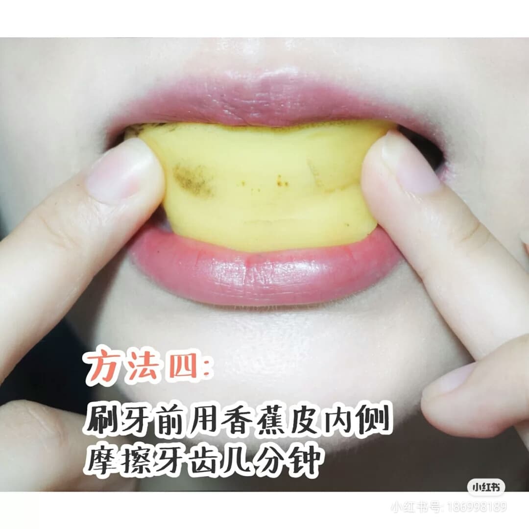 Tips 4 :香蕉皮 香蕉皮内侧的部分含有镁、钾离子,可有效帮助去除牙齿上的污垢~用其擦拭牙齿后静置1分钟,之后如常漱口和刷牙清洁即可~记得不要挑选不够熟、或太熟的香蕉,也不要将香蕉皮放置太久才使用,营养和矿物质流失后使用起来就没有效果啦~