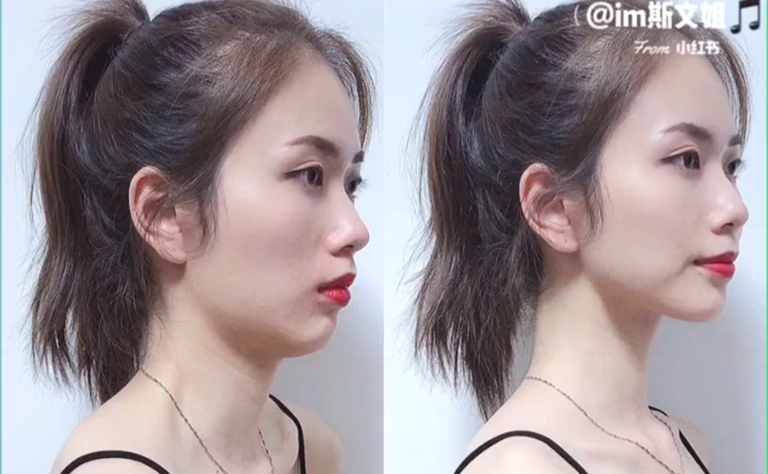 今天来教大家几组头部和颈肩运动,同时达到改善双下巴练出明显下颌线、修饰颈肩线条打造天鹅颈和美背的效果,坚持练一段时间体态和气质都会有明显改善哟~