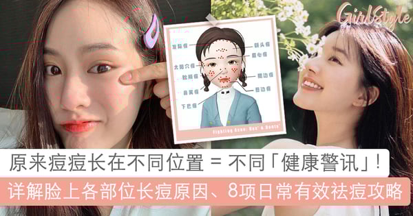 痘痘位置在提醒你这些「健康警讯」！8招实用日常祛痘攻略，养成无瑕牛奶肌