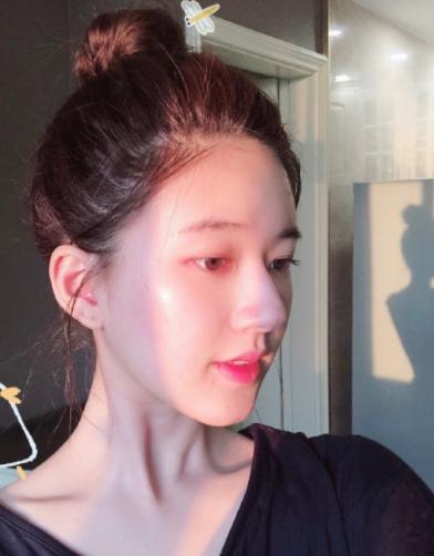 「痘痘」绝对是困扰女生们的美貌仇敌!其实脸上长痘痘的不同部位,很多时候都在提示你不同的「健康警讯」唷~今天除了来科普给女生们脸上各部位长痘痘的原因、方便大家尽早进行身心调理;也会提醒大家一些有效祛痘攻略,希望能帮助你歼灭万恶痘痘,养成干净无瑕牛奶肌肤~❤️