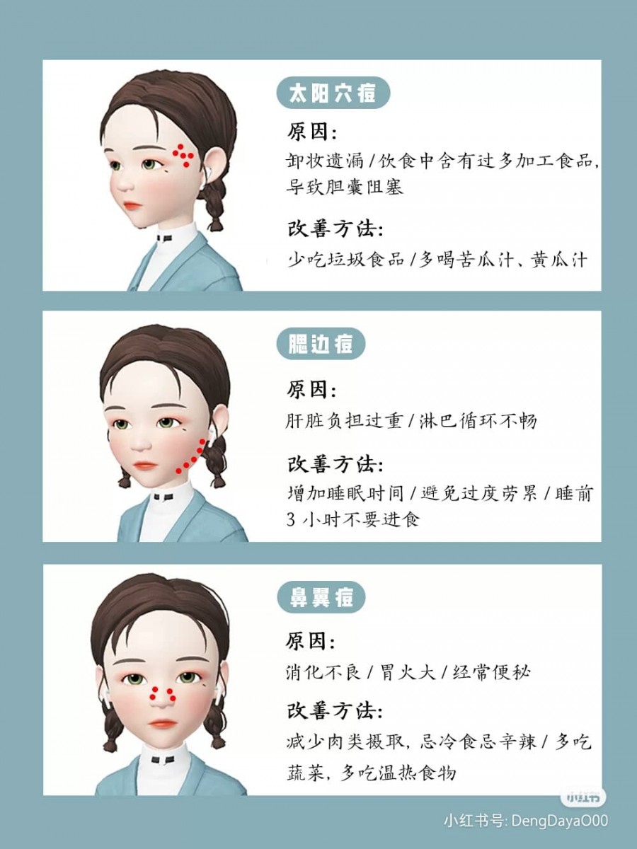 ✨太阳穴痘痘:和发际线长痘痘一样,很可能是因为卸妆清洁没有带到太阳穴导致冒痘;同时也要注意是否胆囊阻塞,一定要少吃加工食品。 ✨腮边(下颌线)痘痘:淋巴排毒循环不佳、肝脏负担过重容易导致这个部位冒痘痘;记得作息照顾好不要让自己过度疲劳。 ✨鼻翼痘痘:很有可能是因为消化不佳、经常便秘和胃火大导致;可以透过减少肉类摄取、忌口辛辣重口味食物,多吃蔬果改善。