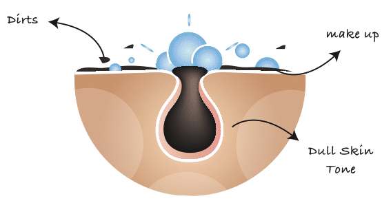 STEP 1 :毛孔深层洁面霜 Corrective Multi Cleanser 首先来给毛孔「洗个澡」,把堆积在毛孔里、会渐渐撑大毛孔和引发痘痘危肌的油脂脏污清洁干净。