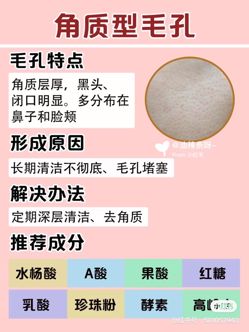 毛孔粗大