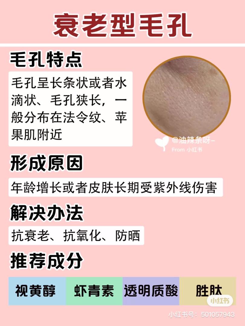 毛孔粗大 3
