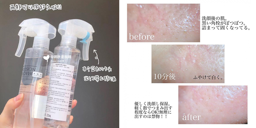 Emulsion Remover 去黑头喷雾 final