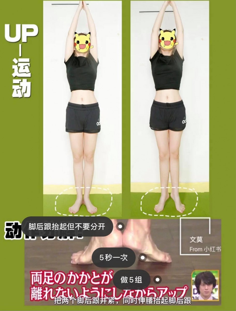 ✨第二招：Up-Down拉伸操 双脚脚掌呈60度、脚后跟紧紧并拢，同时踮脚尖+身体垂直向上伸展，记得同时要收紧腹部唷～这款UP-体操维持5秒动作为一组，每天坚持做5组。