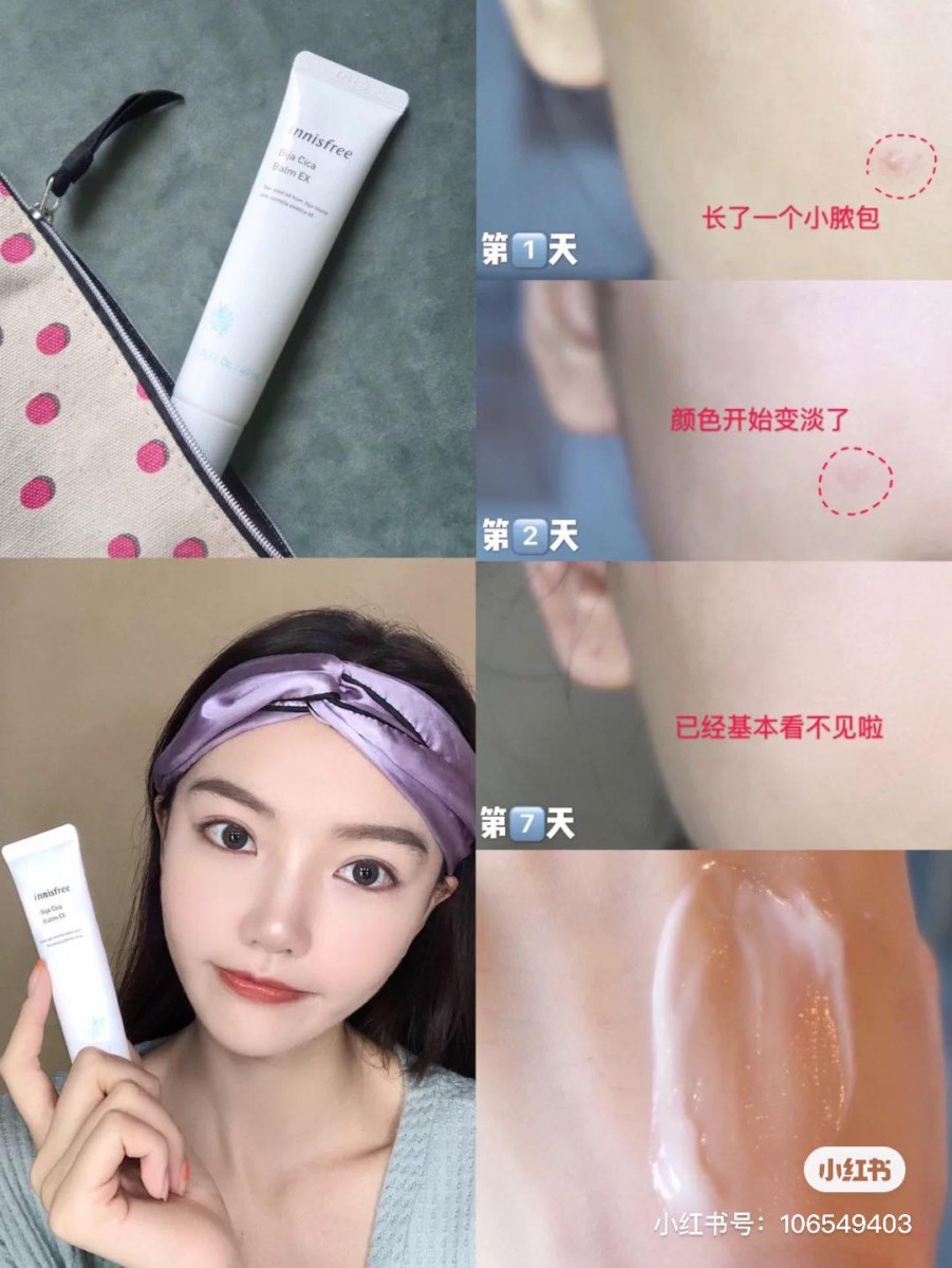TOP 5 :Bija Cica Balm EX 小白管香榧舒缓祛痘修护膏 (40ml / RM102)>> 链接 「小白管」特别适用于舒缓痘痘、淡化痘印和急救舒缓敏感肌肤,内含维生素B5和超浓缩积雪草提取能有效修复肌肤屏障。小红书美妆博主用后推荐:「按照官网税法一天用2次连续3周,陈年老痘印淡化了不少~」、「用在新生痘大概7-10天内就基本消失无踪」,备受痘痘困扰的Girls不妨入手试试!