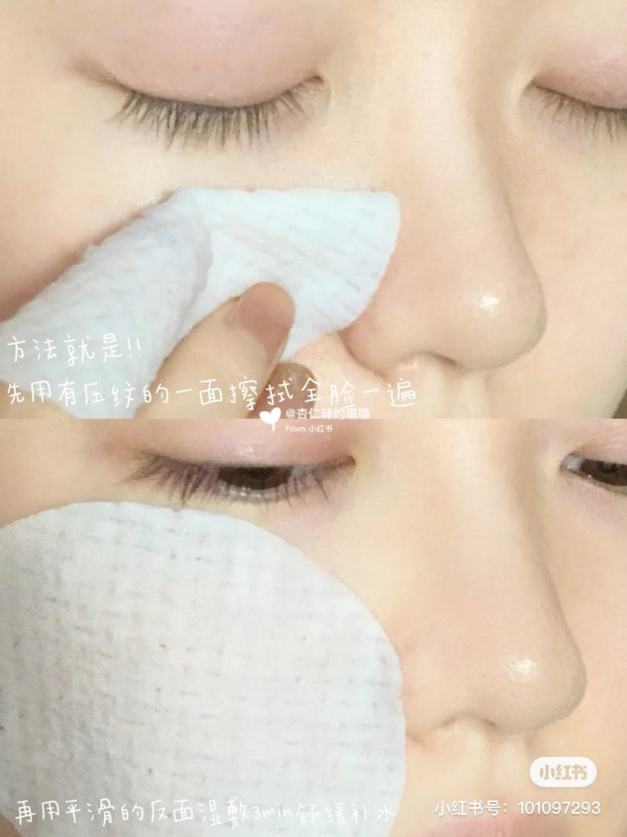 ✨ Papa Recipe 茄子清洁棉片 | RM49 >> 链接 除了先用有压花的那一面可用来擦拭，去油脂和脏污+去角质；之后用平滑的一面来湿敷3-5分钟，舒缓镇静肌肤之余还有补水效果～棉片浸透了有效帮助疏通毛孔、舒缓痘痘的三重果酸和茄果提取精华。小红书博主用后明显颗粒感显粗糙的毛周角化问题有所改善，黑头粉刺和闭口在脸上也不在猖狂肆虐了呢！