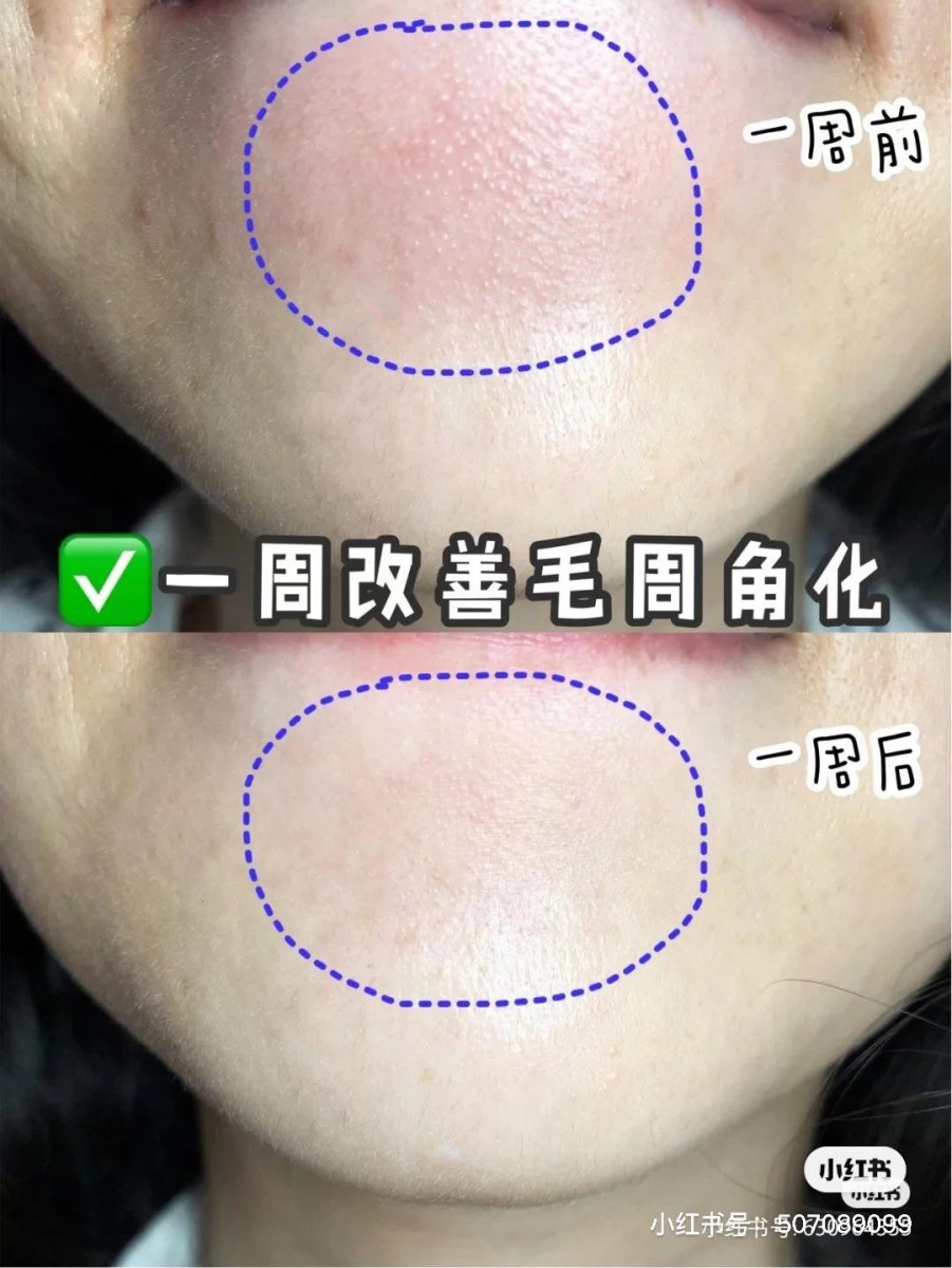 1024koreanskincaretips6