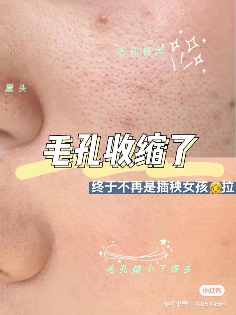 kiehls 面膜 隐藏用法 11