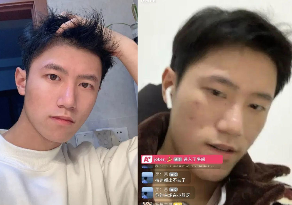 又是一波帅气照片圈粉,但直播真容颜值翻车的案例: