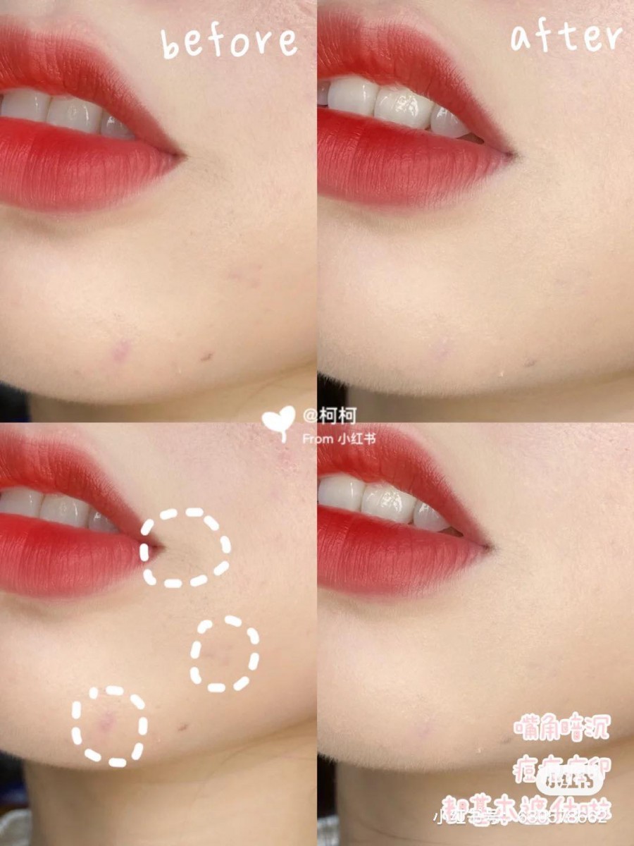 Maybelline Instant Age Rewind Eraser Muti-Use Concealer「橡皮擦」遮瑕液（RM20） >> 链接 上遮瑕液最担心的就是厚重卡纹；Maybelline家的这款橡皮擦遮瑕液一直都是热销款，毛毛软软的海绵头上妆舒适，滋润度够、遮瑕力足但完全不会拔干，用来遮黑眼圈、痘印都很OK！