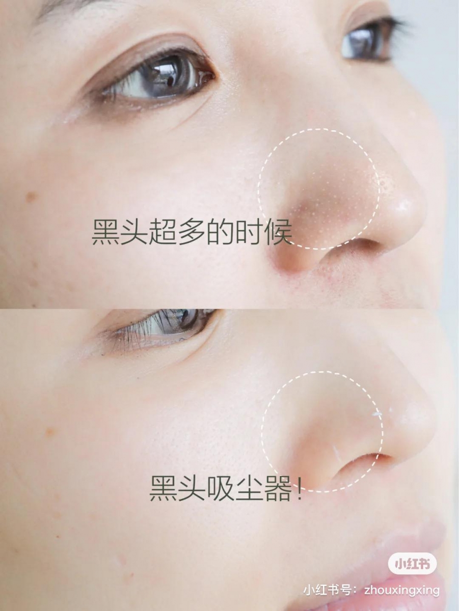 Kiehl's Rare Earth Deep Pore Cleansing Masque 白泥清洁面膜(RM139.70)>> 链接 堪称「毛孔吸尘机」的一款全球热销泥面膜~有着很强的吸附能力和平衡油脂效用,可深层清洁且细致毛孔。