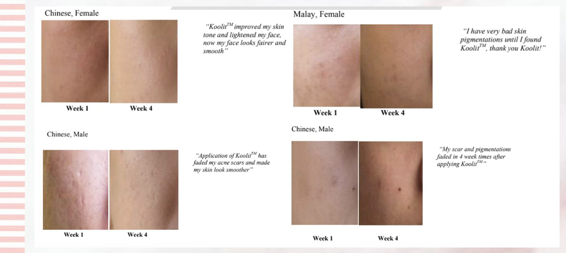 Koolit 1个月见证效果