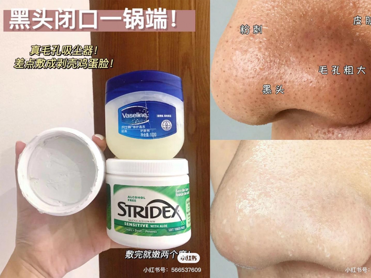 vaseline 黑头
