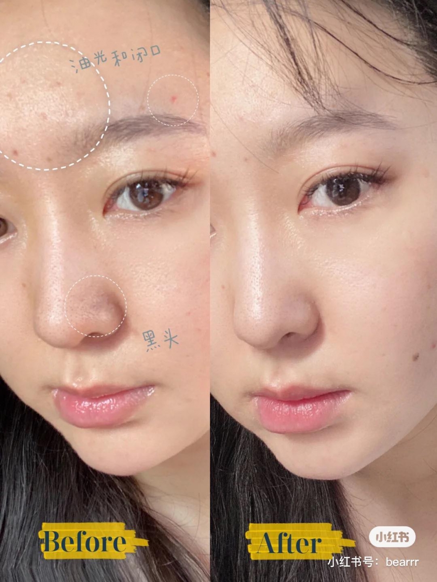 L'Oreal Paris Revitalift Crystal Micro Essence积雪草微精华露 银盖款积雪草微精华适合混合性、油性肌肤使用，作用包含调节肌肤水油平衡、有效改善暗沉粗糙疲劳肌肤，以及黑头、痘痘和闭口问题。质地清爽好吸收的这款微精华露中带酸，可以帮助角质代谢并修护肌肤；平时使用可以轻拍上脸按摩促进吸收，或者用化妆棉打湿后擦拭全脸进行二次清洁。>> 双十二买正装130ml送6支迷你装共132ml RM71.90 【点击查看促销详情】