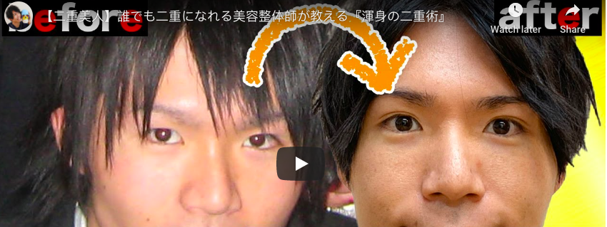 整骨美容师本身的小眼睛变身BlingBling大眼前后对比照也非常励志呢!