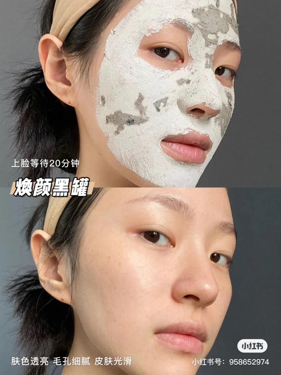 去黑头粉刺特搜好物 2 :GLAMGLOW Youthmud Glow Stimulating Treatment Mask 国外非常火、在小红书上也收获很多好评的这款「小黑罐」GLAMGLOW Youthmud Glow Stimulating Treatment Mask,主打清洁和焕颜;尤其推荐熬夜星人们使用,轻松清洁肌肤毛孔还能拯救暗沉抚平粗糙,帮助肌肤抗氧化!熙春茶嫩叶+火山岩泥成分上脸瞬间被激活进行毛孔杂质脏污大扫除,所以稍微有点刺刺的感觉那是正常的~ 用10+分钟后手指沾水打圈按摩边清洗干净,皮肤就像体验过一场「急救行动」,粗糙感和暗沉肤色明显改善,小红书博主表示效果有点像肌肤被抛光打磨一番光滑感MAX!推荐中性肌肤和油性肌肤使用。