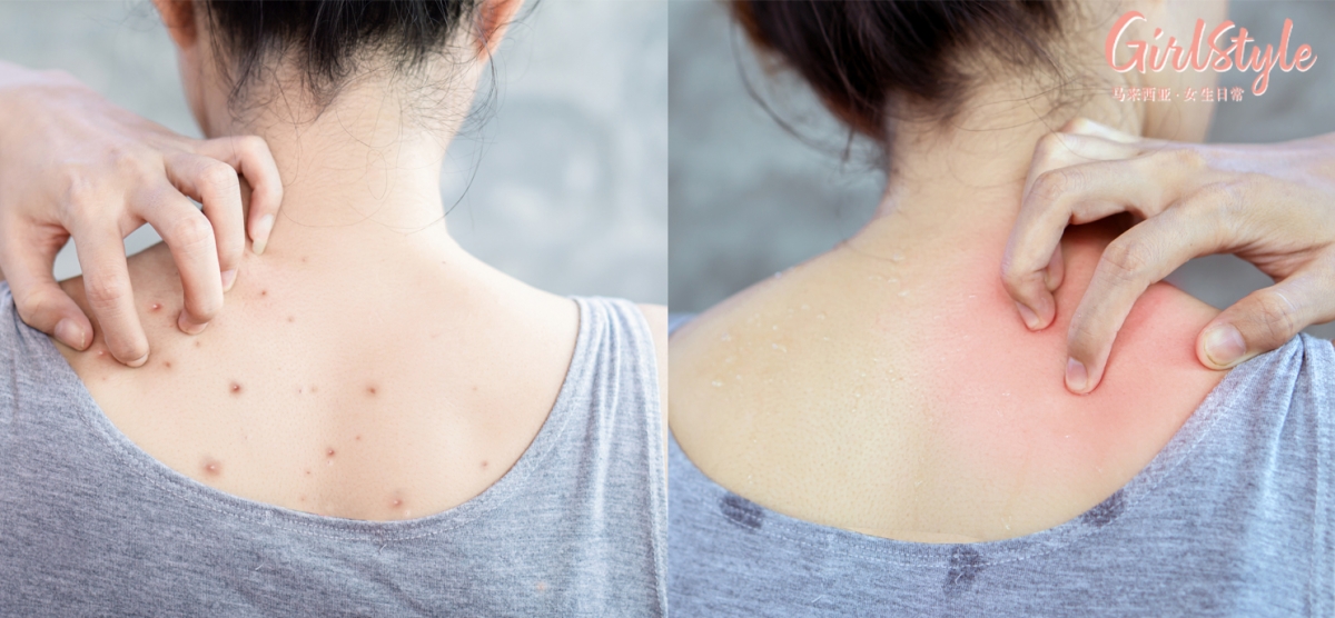 「清洁」和「保湿滋润」对于脸部肌肤保养的重要性，相信女生们都了解～大面积的身体肌肤其实也同样需要悉心呵护吖！呆在冷气室内皮肤水分很容易不知不觉被抽干引致水油不平衡、走在户外瞬间就会沾染到环境中各种灰尘脏污；没有好好保养的话，身体肌肤很容易闹脾气，不仅粗糙紧绷还容易爆发「背痘」危肌！