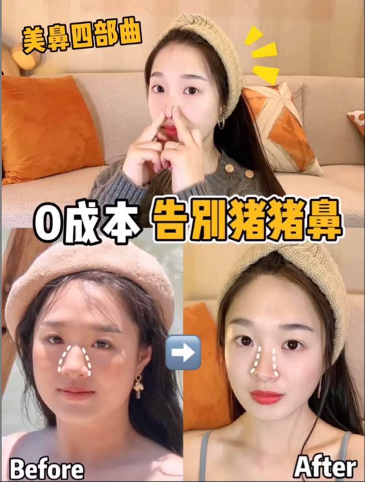 精致小翘鼻是女神感「侧颜杀」标配～想要改善塌鼻梁和大鼻头的Girls，一定要笔记好今天这组可以有助缩小鼻头、塑形山根的「30秒美鼻按摩」4部曲勤加练习！看看小红书博主 @ 小石头 亲测一段时间后的Before vs After变化，真的太让人惊艳啦～