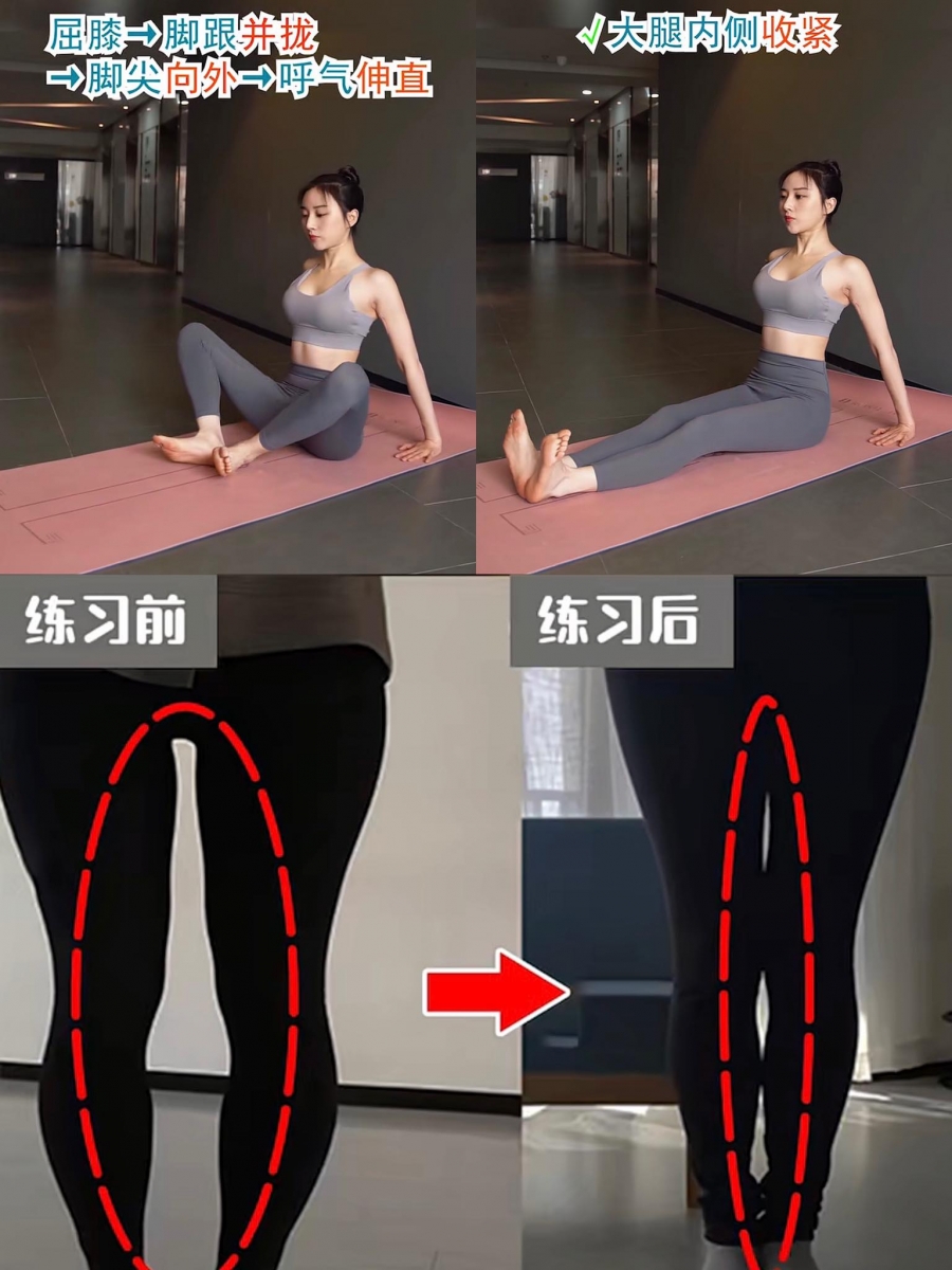 动作三:束脚直推式 坐在瑜伽垫上、屈膝+双脚后脚跟并拢,脚尖向外;维持这个姿势,呼气时双腿往前伸直至双腿逐渐并拢,会明显感受到大腿内部肌肉的收紧感。共做20次 x 3组,不仅能收紧大腿内侧赘肉,还能有效改善O型腿问题,让双腿真正实现「又细又直」即视感~