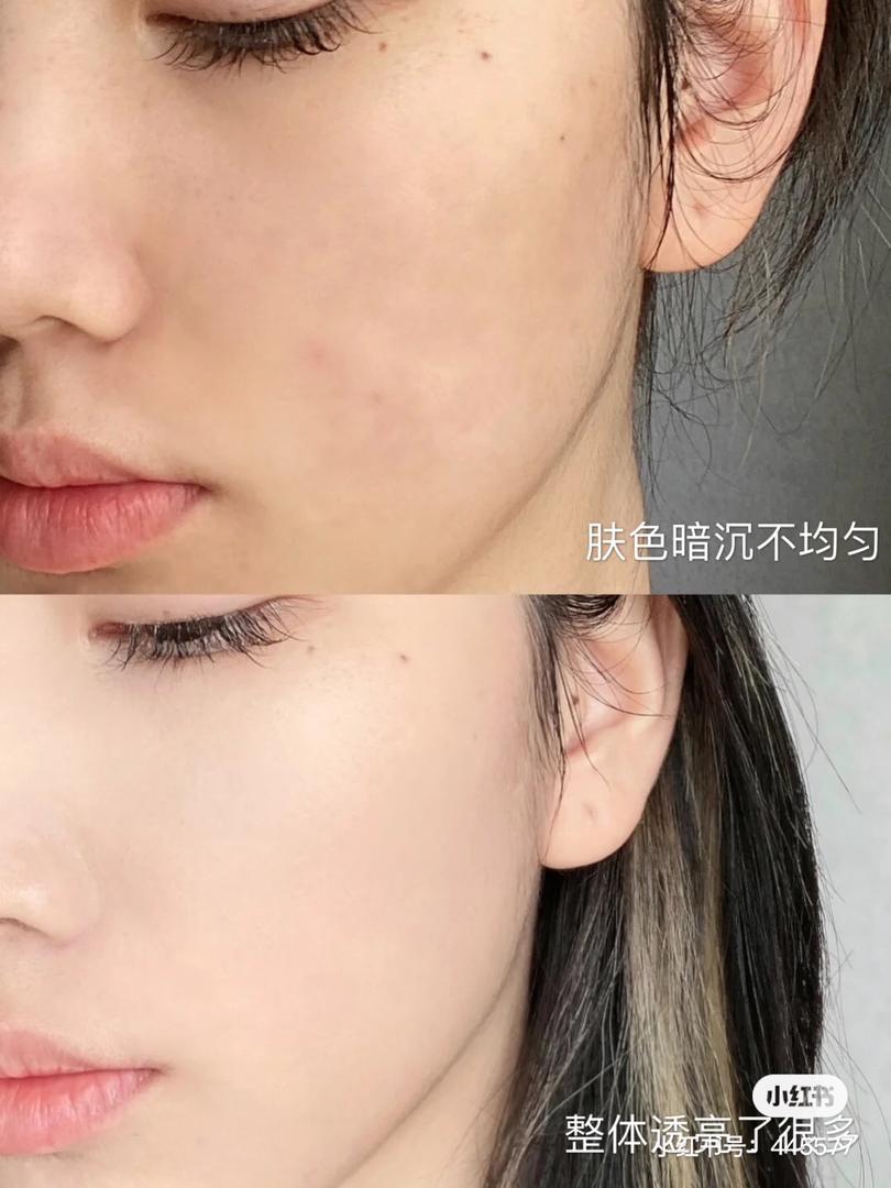 美白精华 2