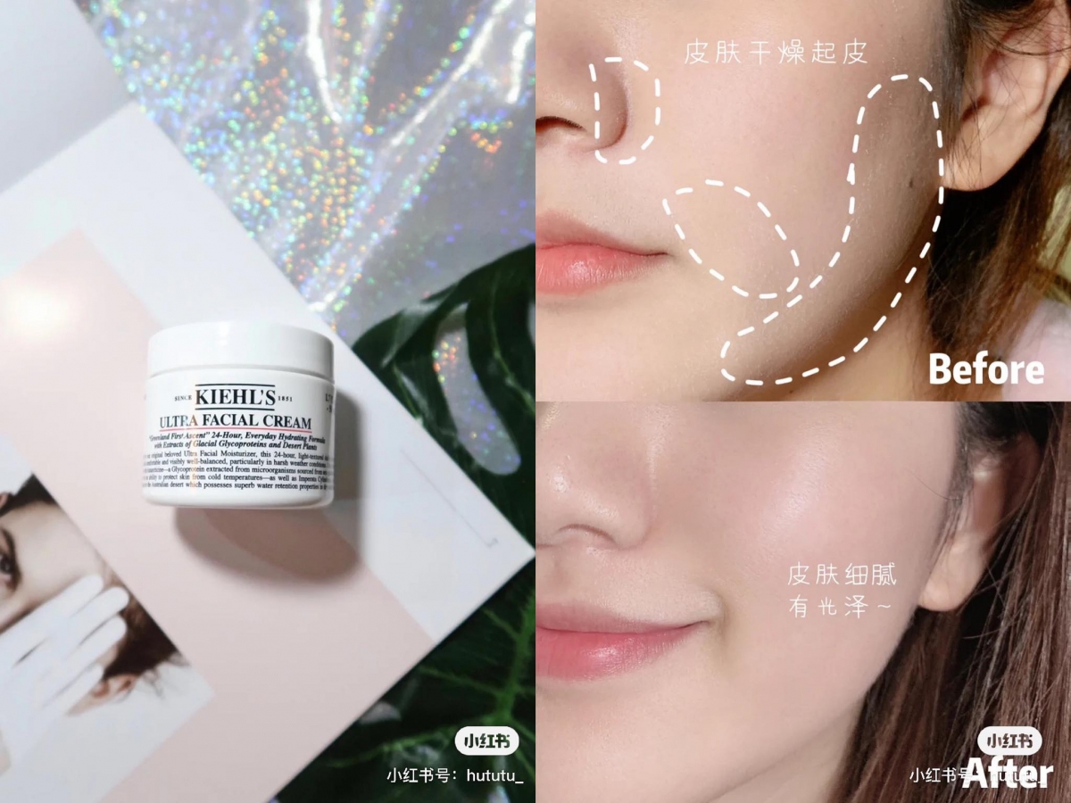 TOP 5 :Kiehl's Ultra Facial Cream