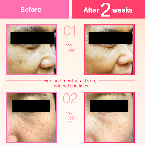 余仁生nanollogen 冻龄圣品