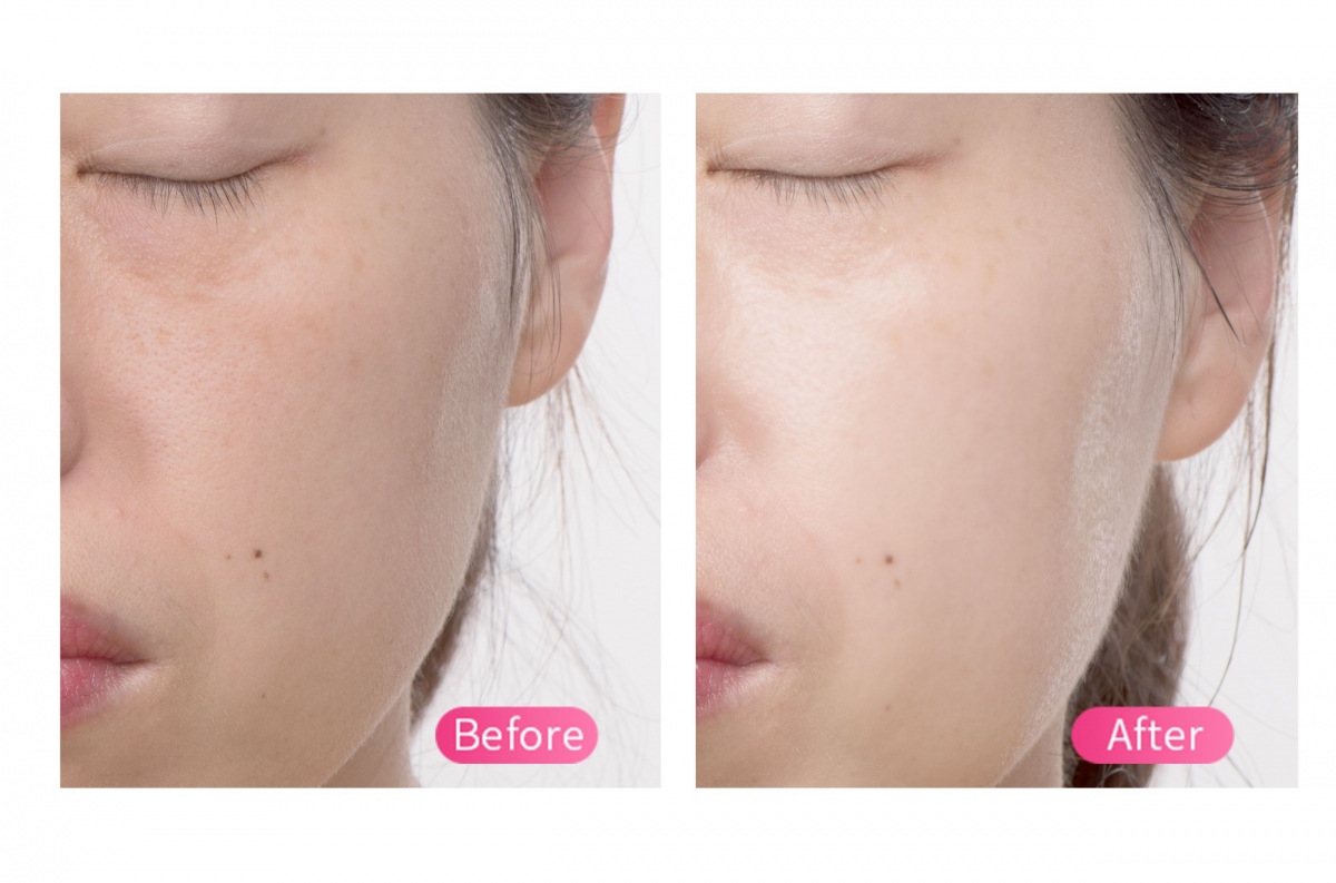 foreo UFO 2(7)