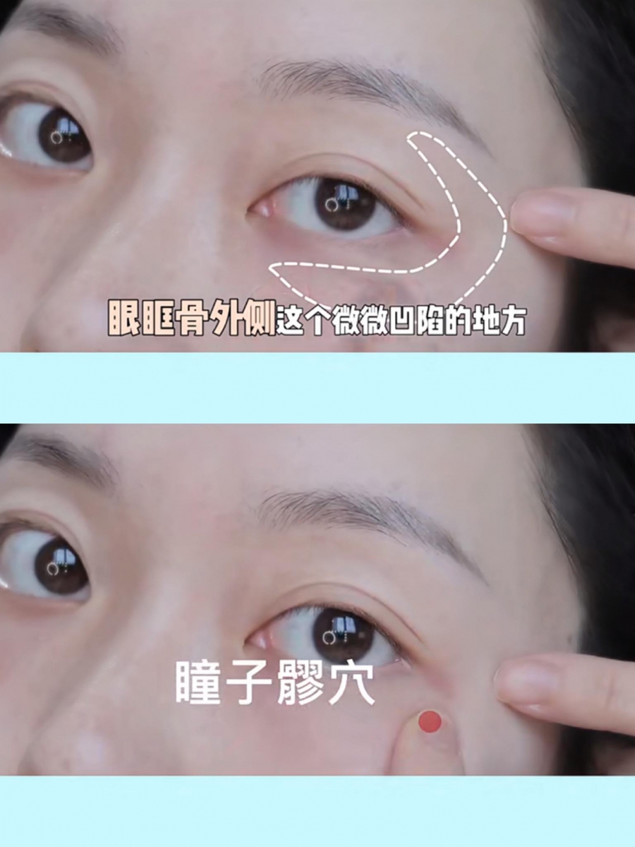 步骤(二)眼眶骨外侧、即眼尾周围稍微凹陷进去的位置,这边的瞳子髎穴轻轻点按可以帮助促进眼周肌肤血液循环,有效预防黑眼圈、眼袋和鱼尾纹。