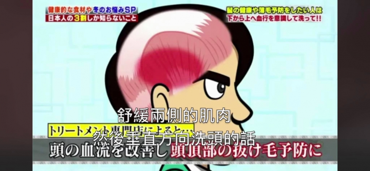 步骤(三)预防掉发洗头手法 日本专业发型师建议,洗头时在头部两侧按摩舒缓侧头肌,然后从头侧沿着耳朵对上的位置,由下往上来回多次以垂直方向按摩到头顶。这个按摩手法原理在于,头部两侧大血管血流会经过耳朵前面再流到头顶部;因此可以透过该手势舒缓侧头肌、促进血流往头顶部流动,达到预防掉发效果。