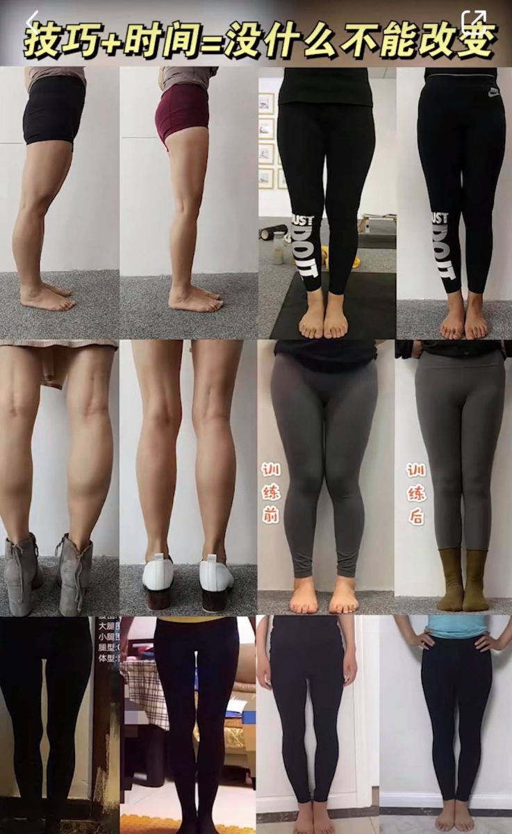 详解动作要诀后Rosie也再三强调「技巧加上实践,没有什么不能改变」,以她自己为例,从小困扰多年的腿型问题也在坚持运动下完美修正,她能做到、屏幕前的你也定能做到~赶紧转发收藏这篇干货知识,趁宅家防疫期间好好锻炼吧 ♥ >>> 详细动态教程