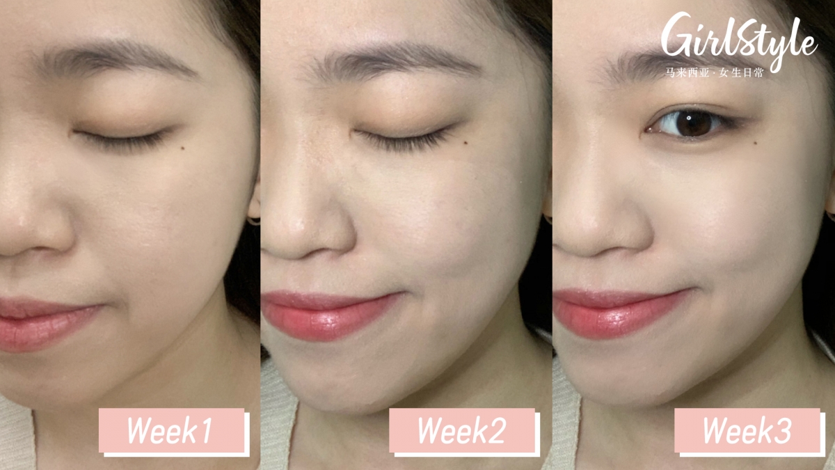 而且Total Image在保养品领域有着超过30年业内经验,一直深受消费者信赖。旗下这款常年热销、顾客回购率很高的Total Image Collagen享有好口碑的同时,也经过马来西亚卫生部注册和品质检测,无论男生、女生都能安心食用哦~