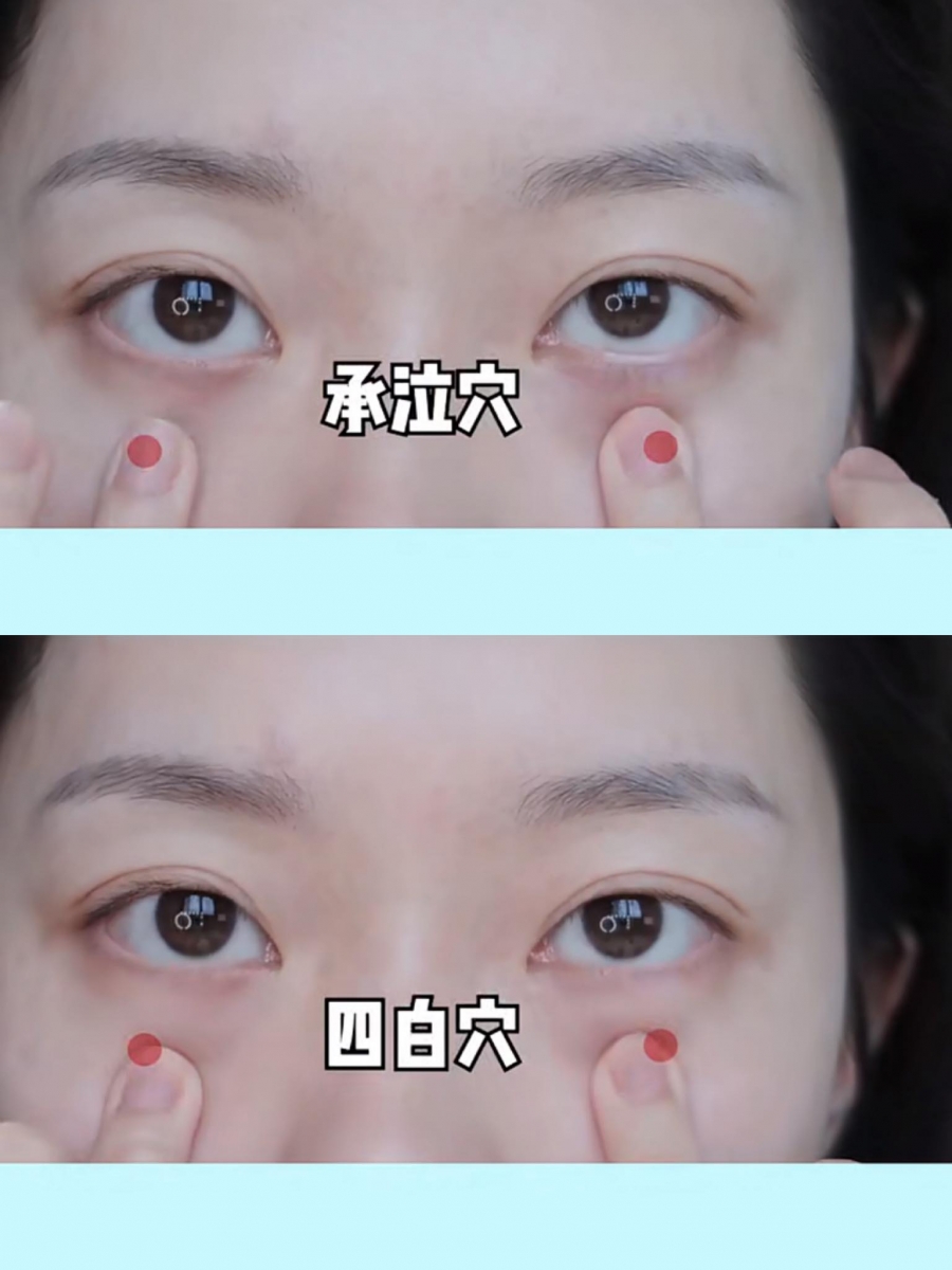 步骤(一)黑眼珠正下方、距离眼球一个指甲盖大小的眼下肌肤位置是「承泣穴」;黑眼珠正下方、距离眼球两个指甲盖大小的眼下肌肤位置是「四白穴」,轻轻点按这两个穴位可以帮助疏通经络、缓解眼部疲劳。改善眼部疲劳的同时对于延缓眼周老化问题有很直接的帮助