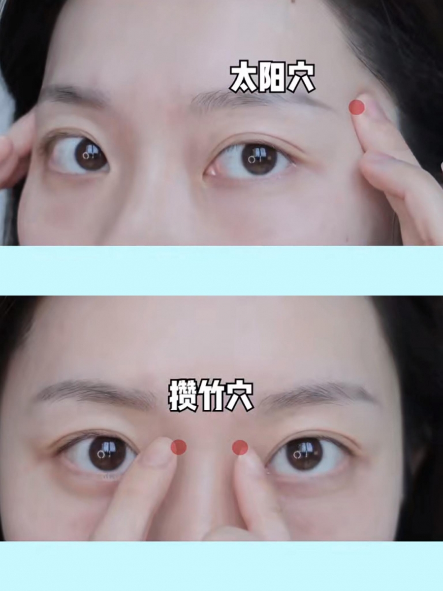 步骤(三)太阳穴、眼头靠近鼻梁山根处的攒竹穴进行按摩,能帮助缓解头部和眼部疲劳;尤其推荐给平日里需要长时间面对电脑、常熬夜的女生。