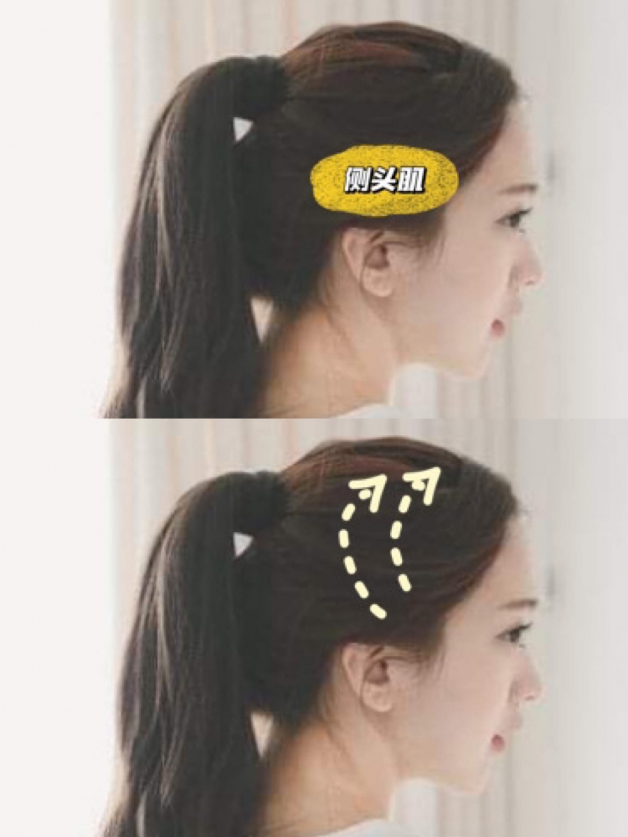 步骤(三)预防掉发洗头手法 日本专业发型师建议,洗头时在头部两侧按摩舒缓侧头肌,然后从头侧沿着耳朵对上的位置,由下往上来回多次以垂直方向按摩到头顶。这个按摩手法原理在于,头部两侧大血管血流会经过耳朵前面再流到头顶部;因此可以透过该手势舒缓侧头肌、促进血流往头顶部流动,达到预防掉发效果。