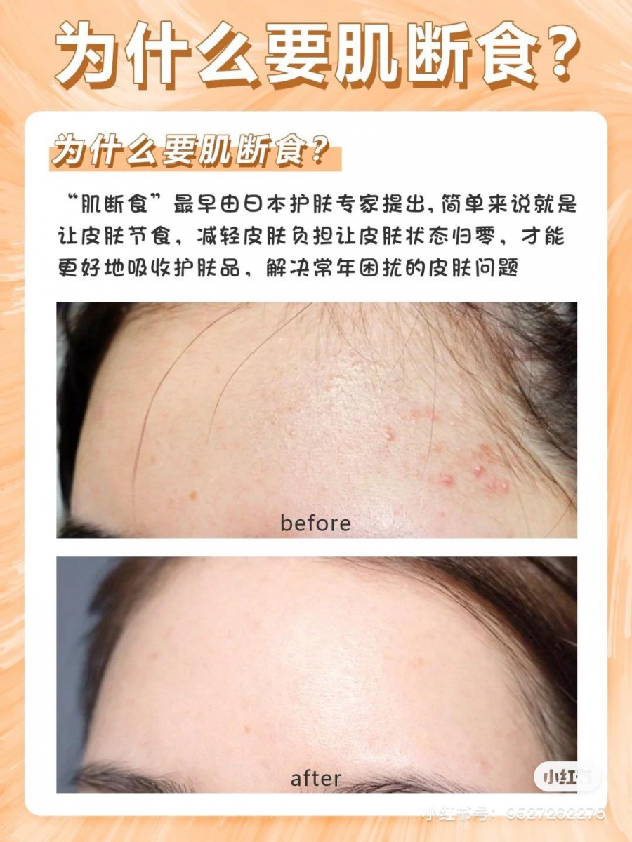 0606skincaretips10