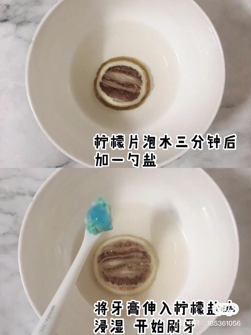 美白牙齿 3