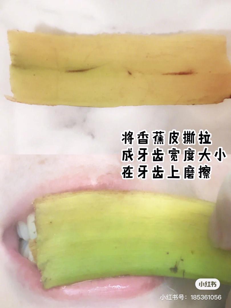 美白牙齿 4
