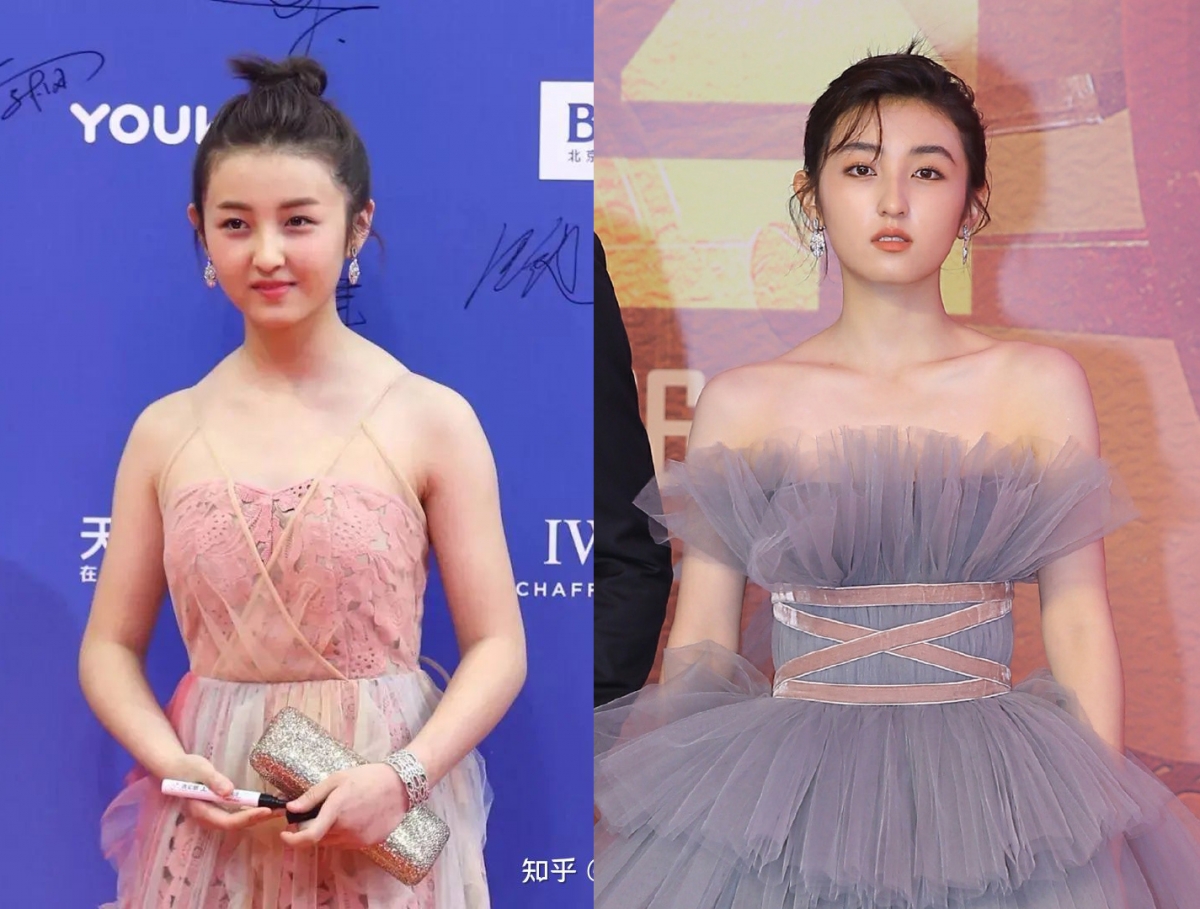 直角肩有多提气质?中国影视圈「国民妹妹」张子枫此前也被网民截图对比过「改善斜方肌问题」前后变化,整个人体态上真的差很多啊!